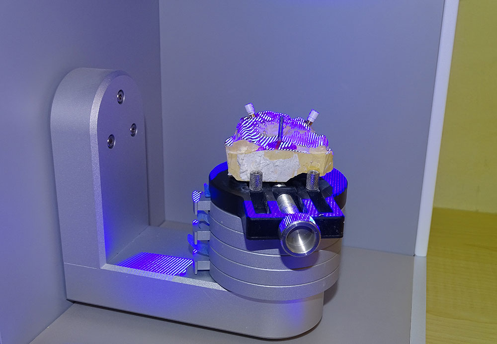 CAD-CAM